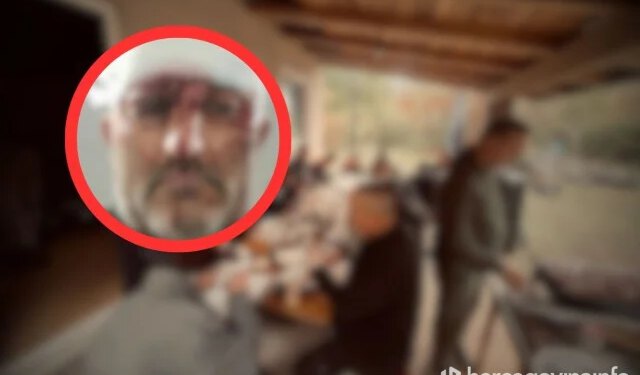 Čitlučanin brutalno pretučen u Širokom Brijegu, tvrdi da su ga napali vojnici OS BiH