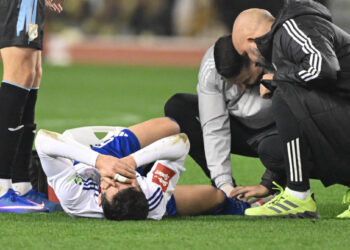 Sportske novosti – Eksplozivniji nogomet donio epidemiju pucanja križnih ligamenata